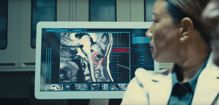 a screenshot from The Suicide Squad depicting a bomb being inserted into a prisoner's brain stem.